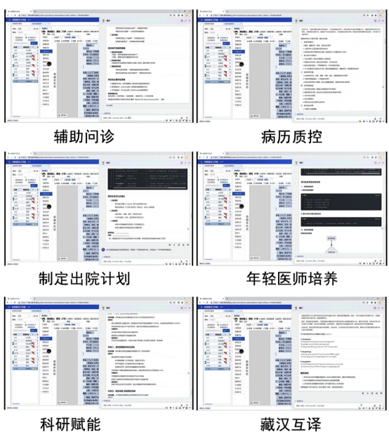 引入AI輔助診療系統(tǒng)。德格縣人民醫(yī)院供圖